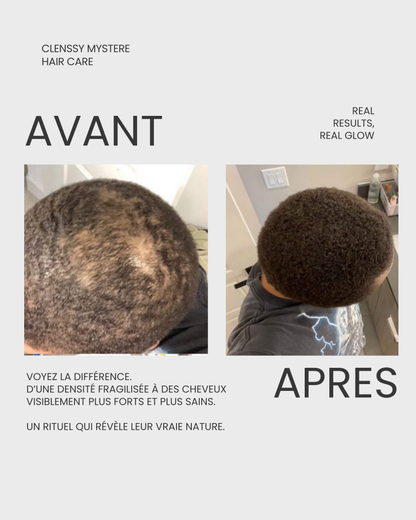 ROSEMARY HAIR GROWTH OIL - Huile de Croissance Capillaire au Romarin