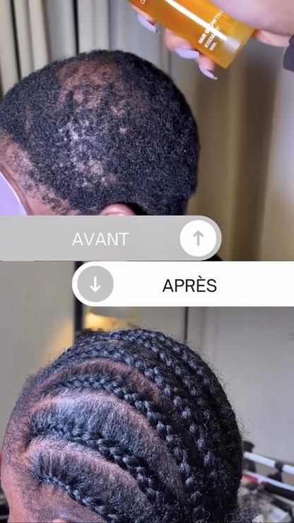 ROSEMARY HAIR GROWTH OIL - Huile de Croissance Capillaire au Romarin